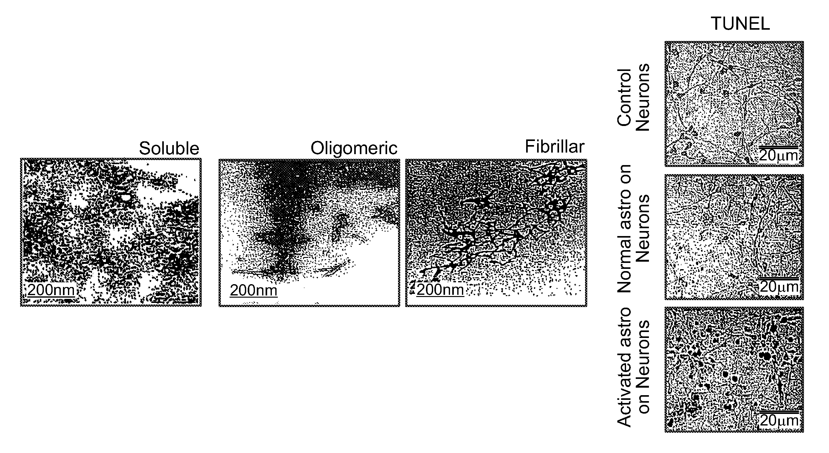 Antisense oligonucleotides against neutral sphingomyelinase and neutral sphingomyelinase inhibitor GW4869 for degenerative neurological disorders