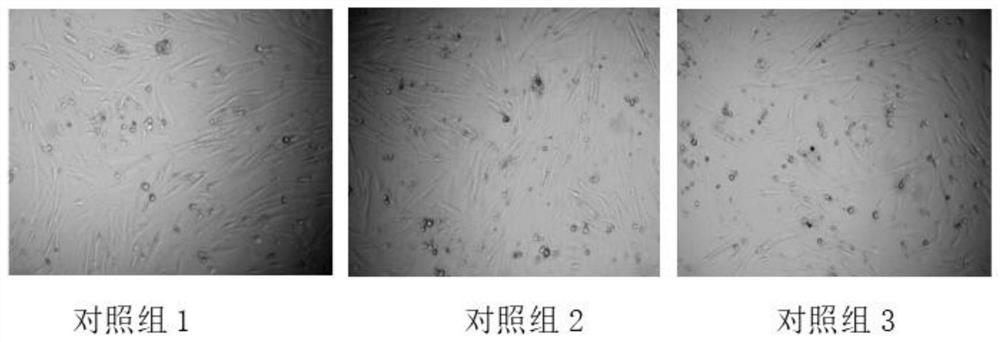 Composition for treating alopecia and preparation method thereof