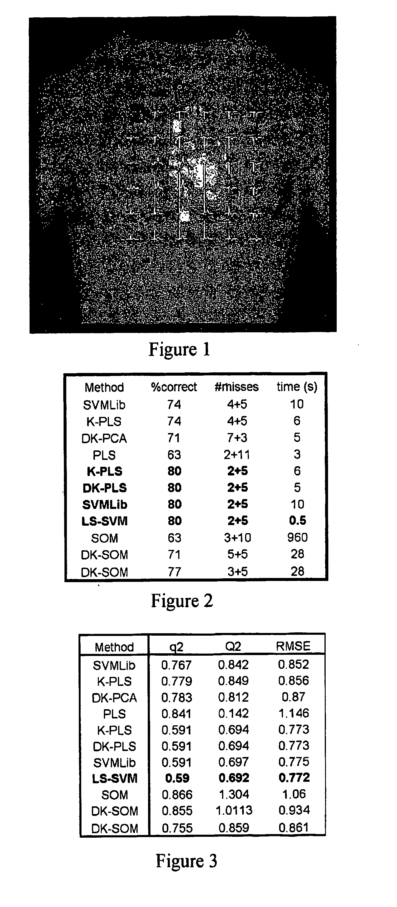 Use of machine learning for classification of magneto cardiograms