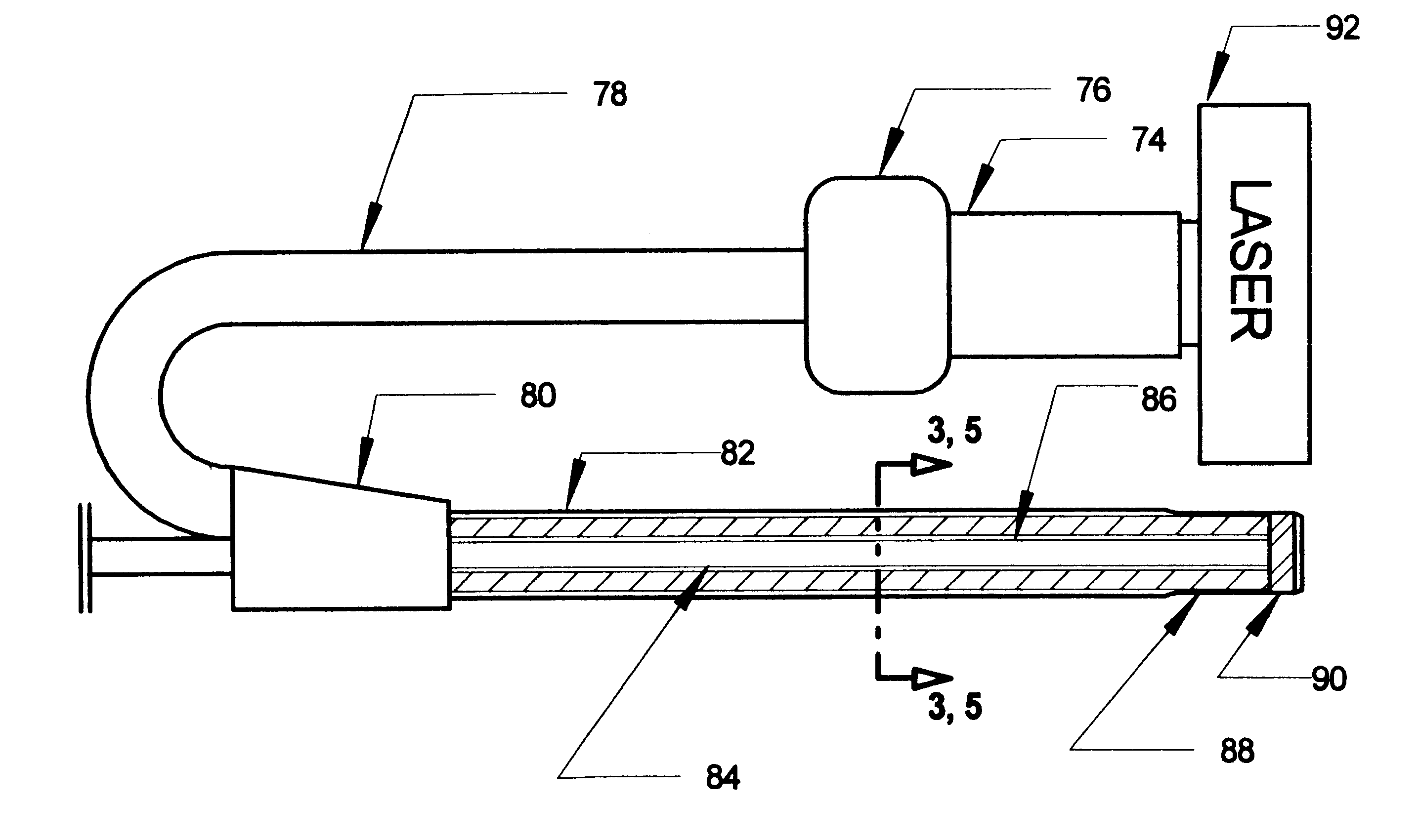 Excimer laser catheter