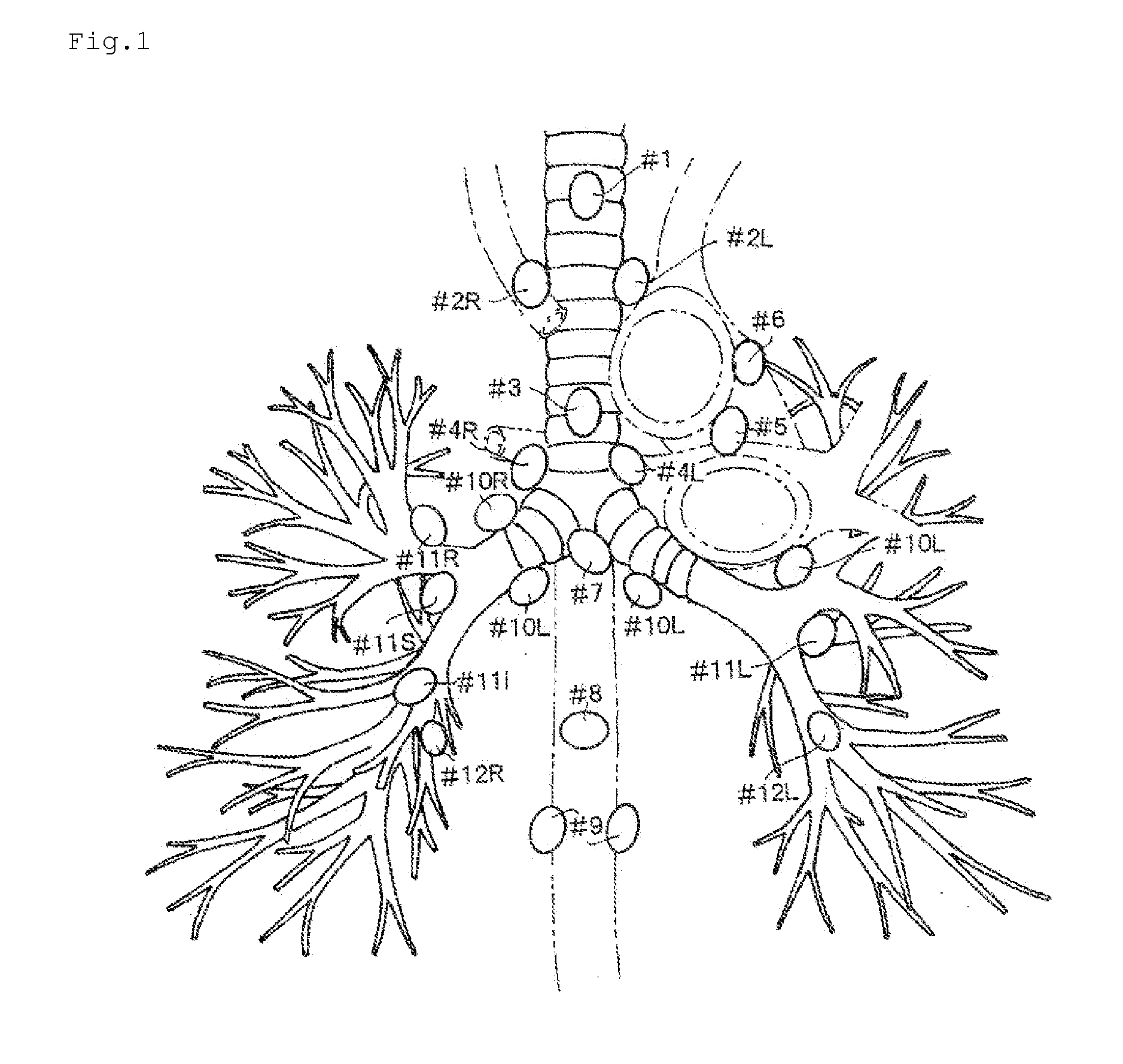 Training model for ultrasonic bronchoscopy