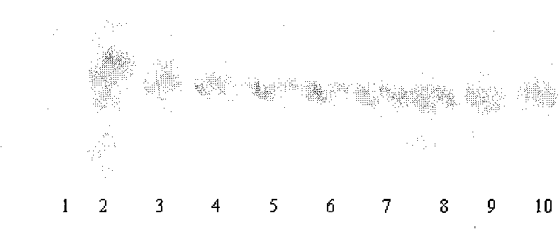 Protease, preparation method of same, as well as application and pharmaceutical formulation thereof