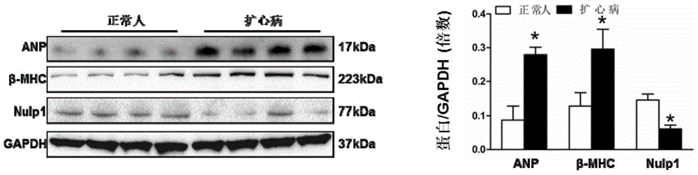 The function and application of nuclear localization protein 1 (nulp1) in the treatment of cardiac hypertrophy