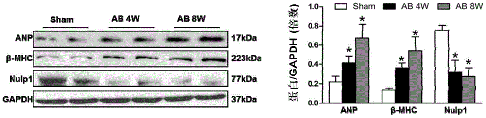 The function and application of nuclear localization protein 1 (nulp1) in the treatment of cardiac hypertrophy