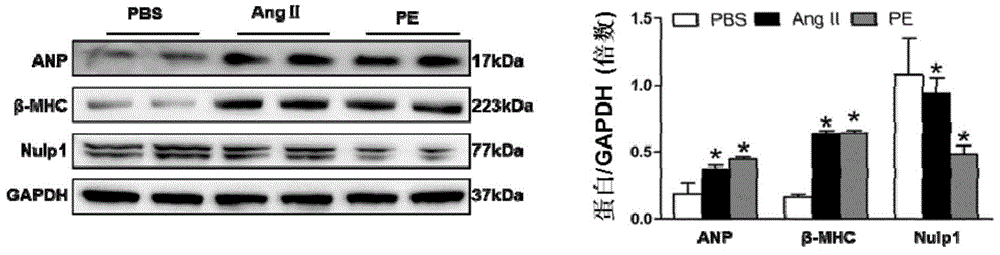 The function and application of nuclear localization protein 1 (nulp1) in the treatment of cardiac hypertrophy