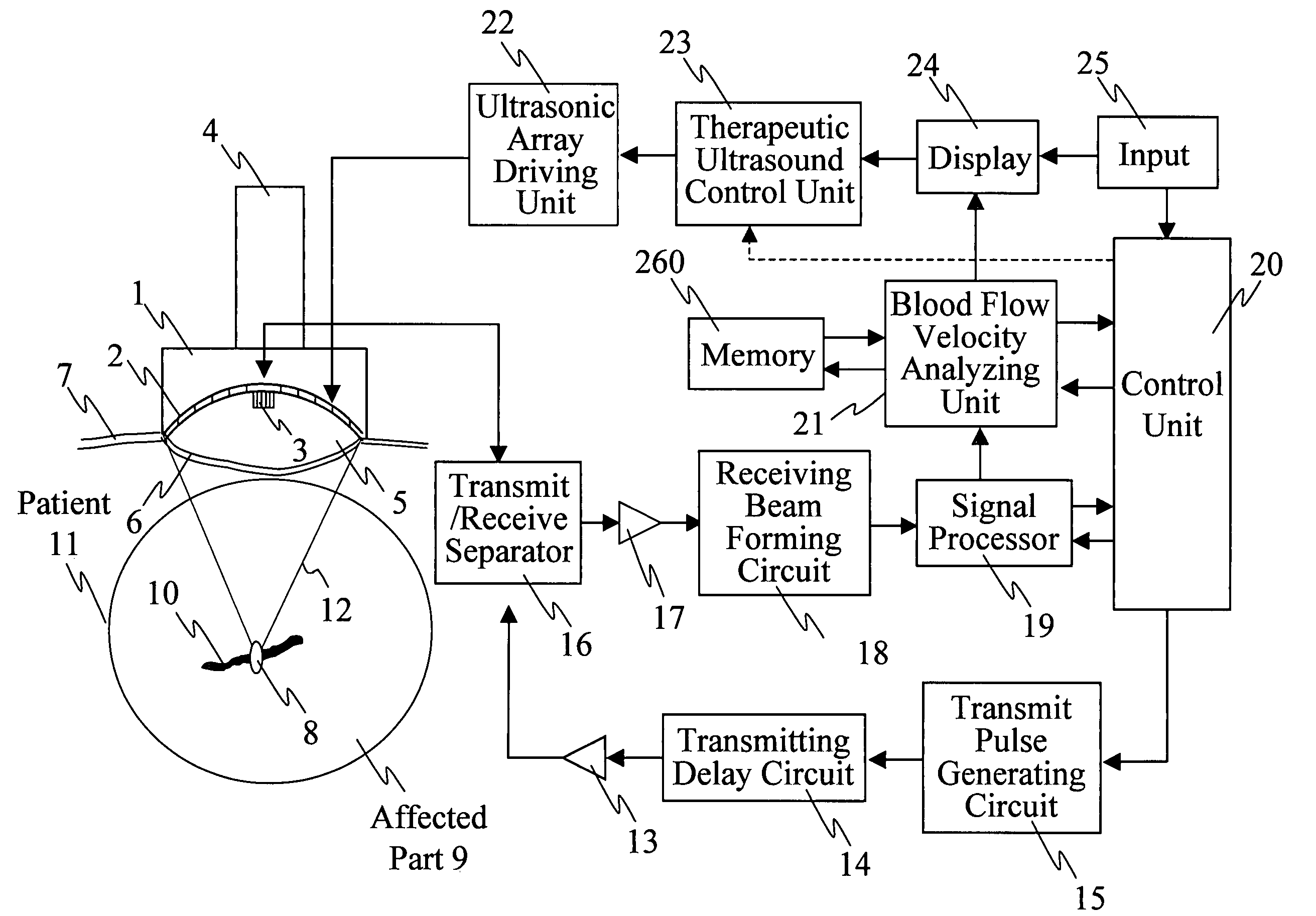 Ultrasonic treatment equipment