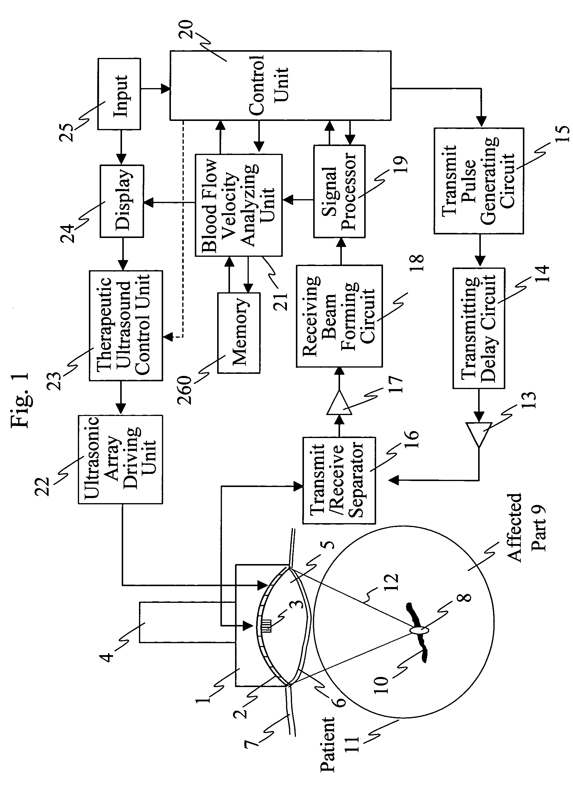 Ultrasonic treatment equipment