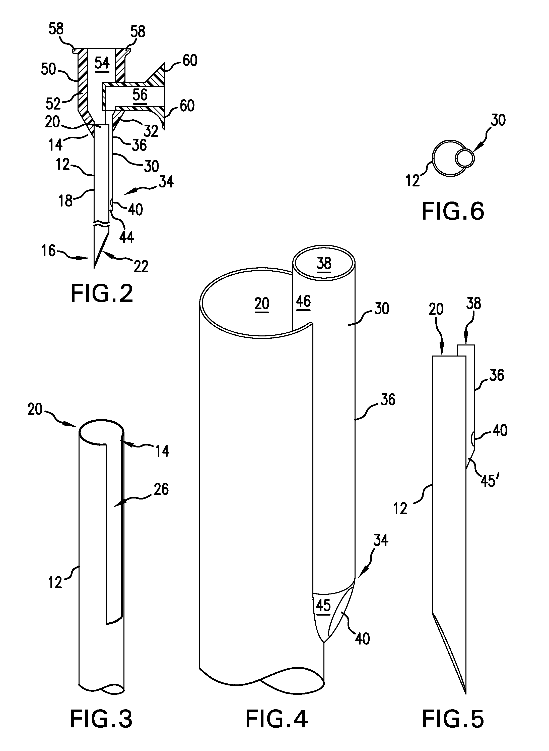 Dual-lumen needle with an elongate notch opening