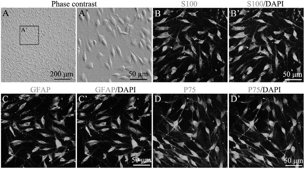 Schwann cell extraction, purification and culture method