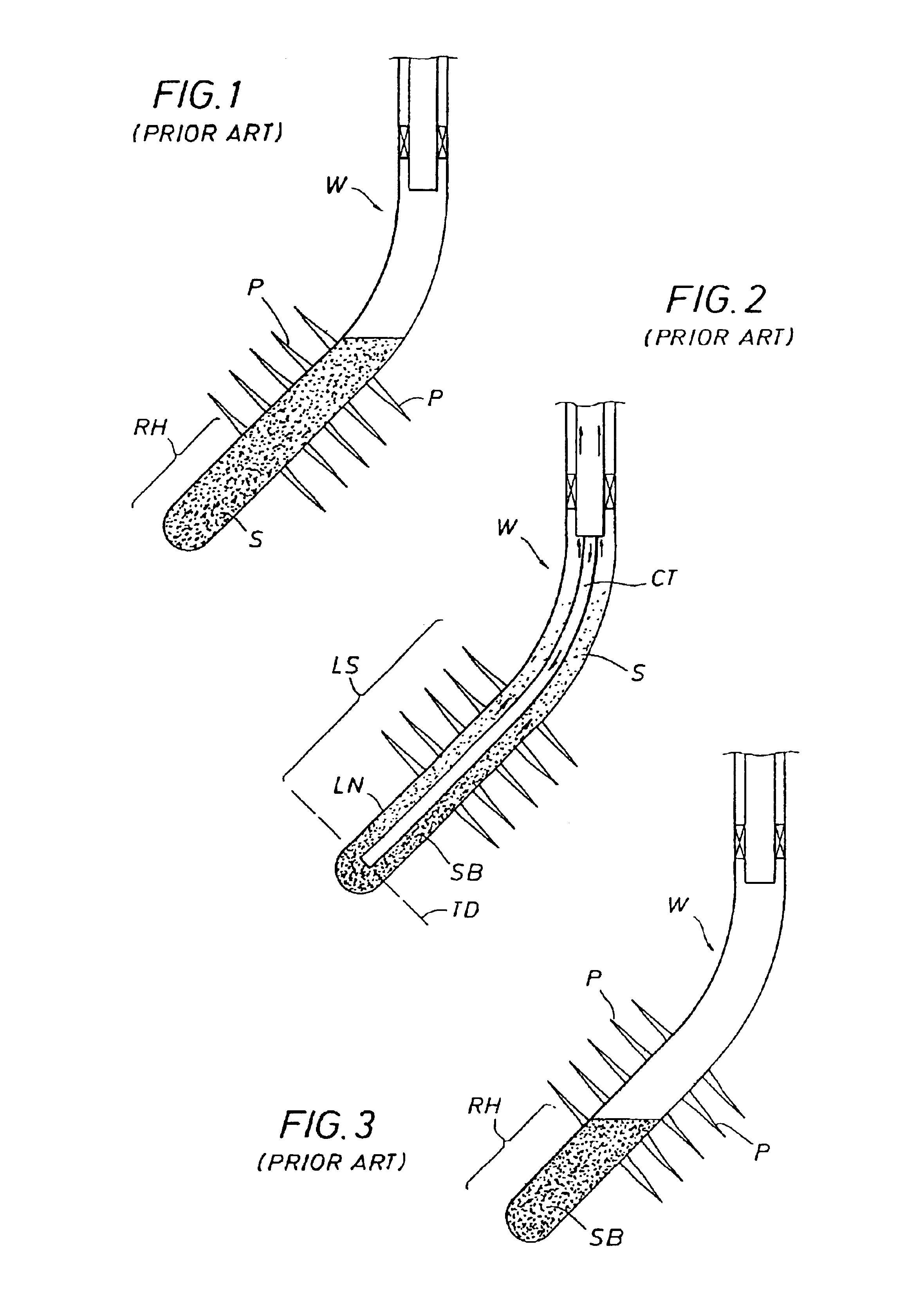 Coiled tubing wellbore cleanout