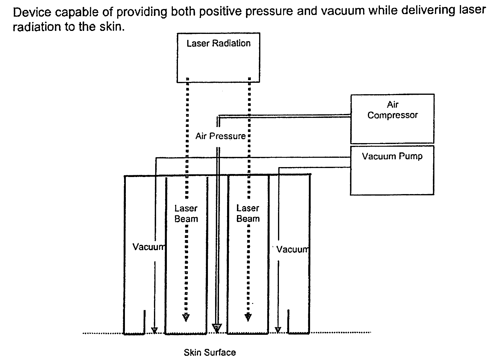 Methods of increasing skin permeability by treatment with electromagnetic radiation