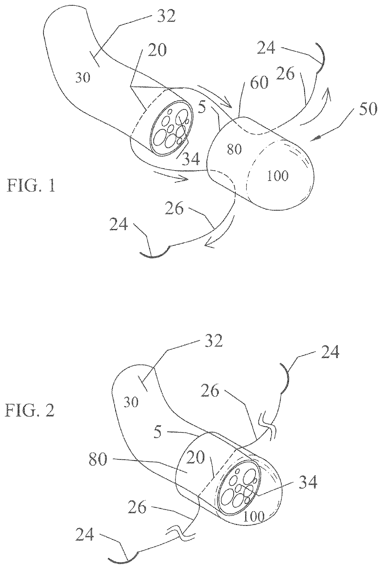 Implant devices with a pre-set pulley system