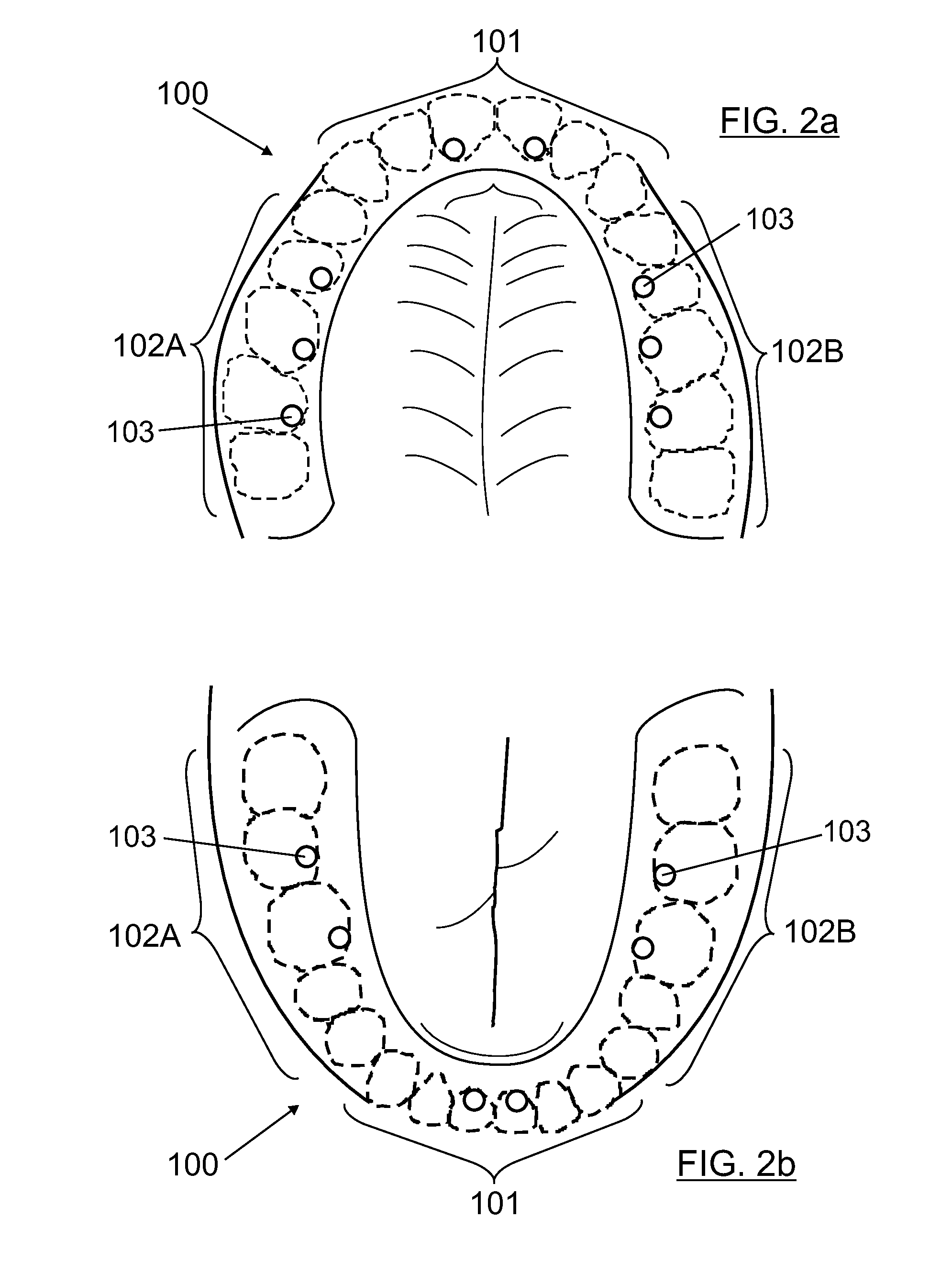 Dental prosthesis