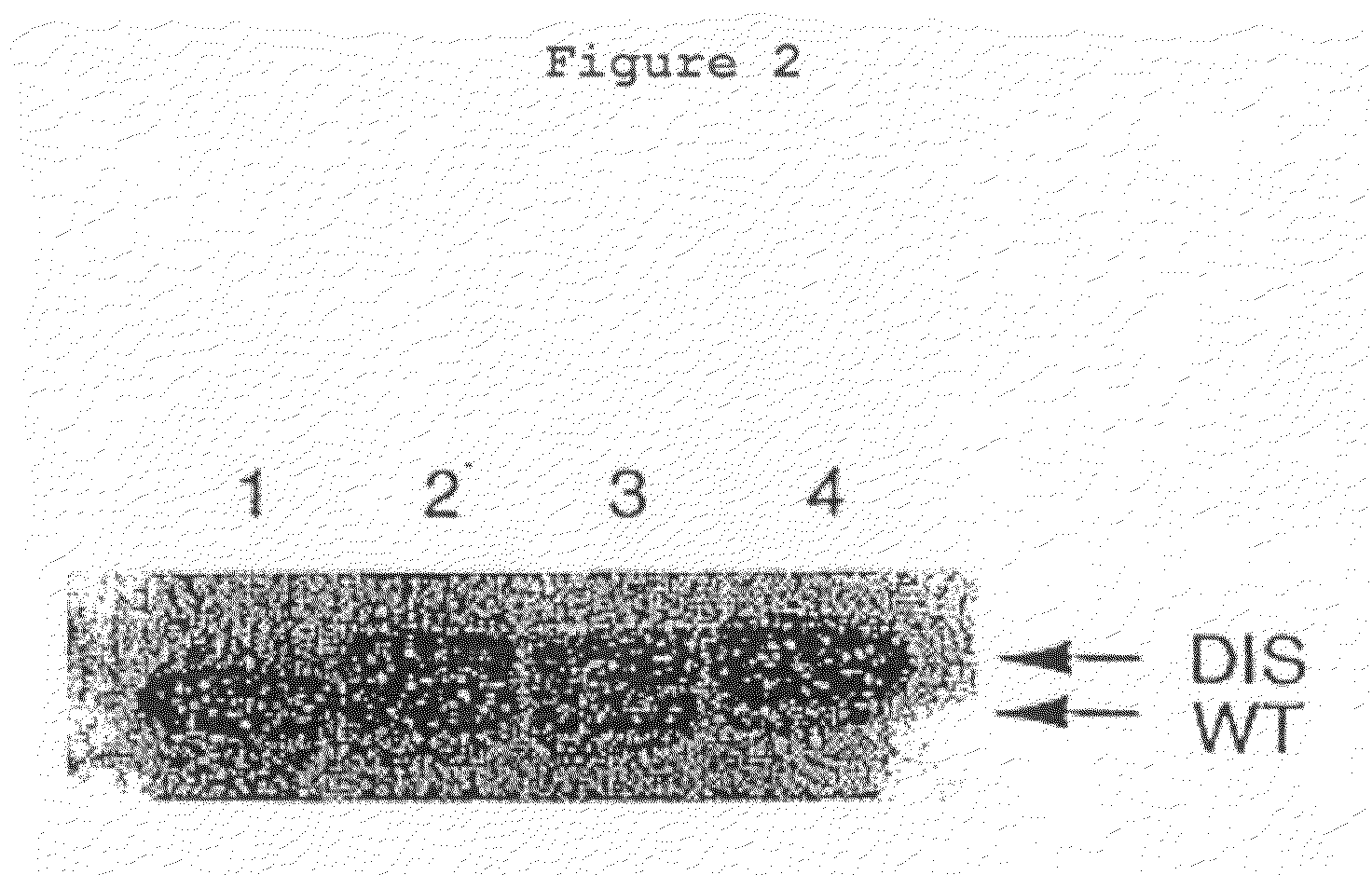 Osteopontin Specific Antibodies and Methods of Use Thereof