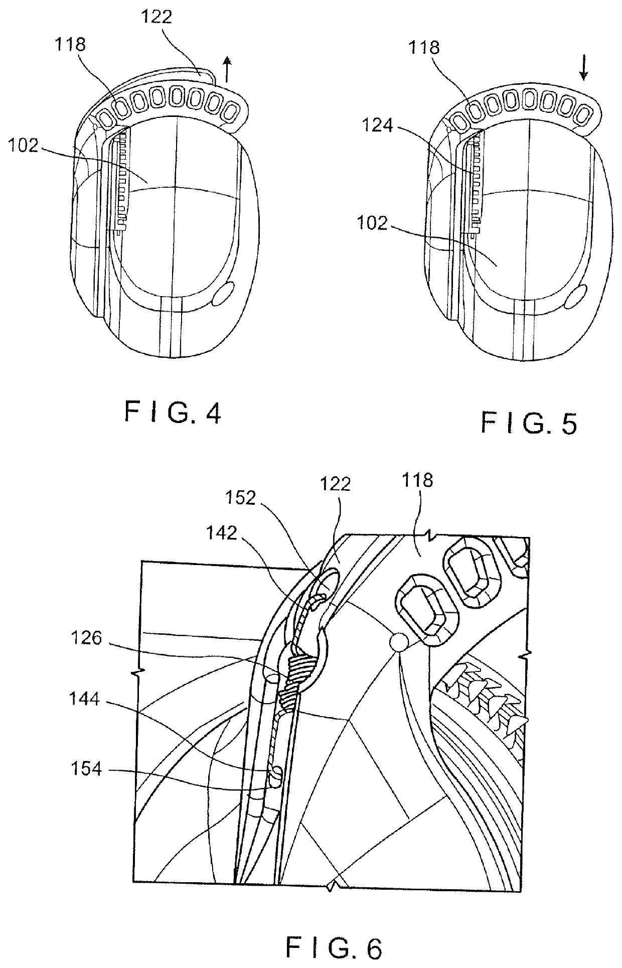 Ureteroscope device and method for using of such a device