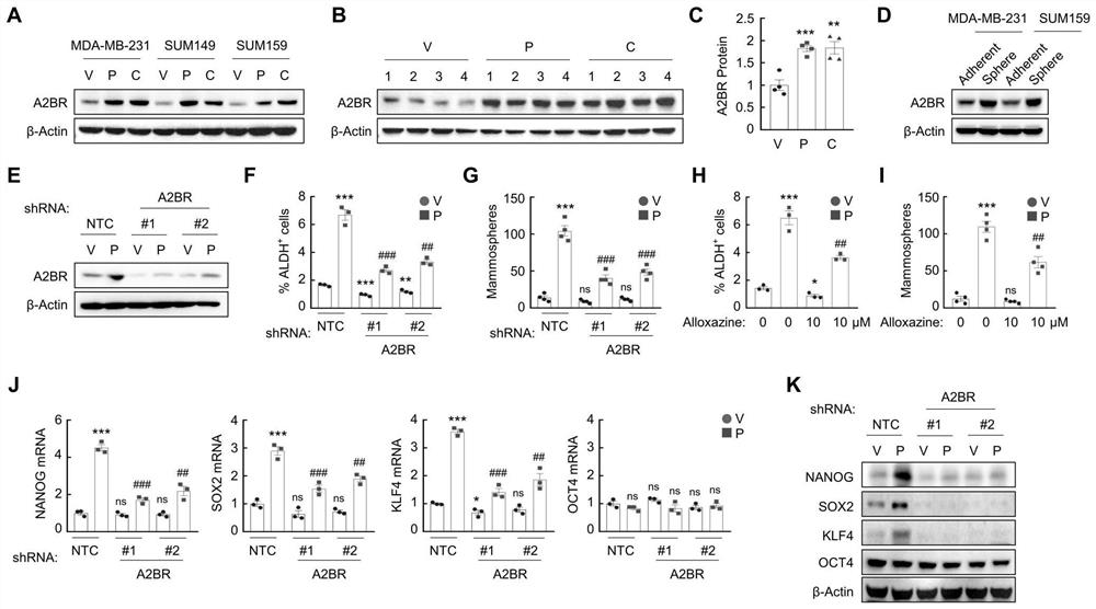 Application of targeted A2BR combined chemotherapy in treatment of triple negative breast cancer