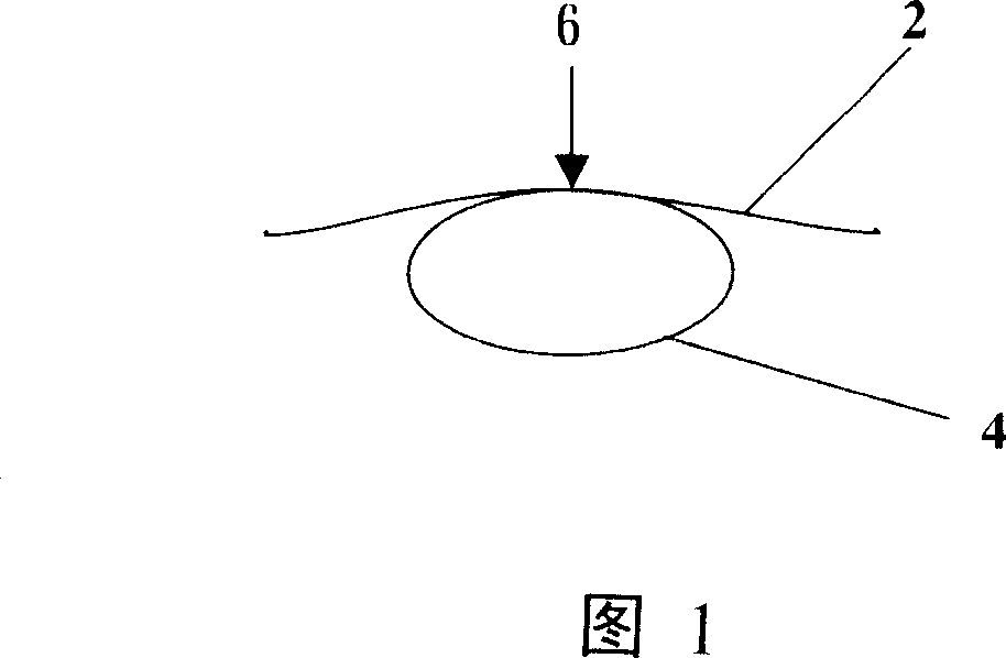 Instrumentation system and method for vein rib point