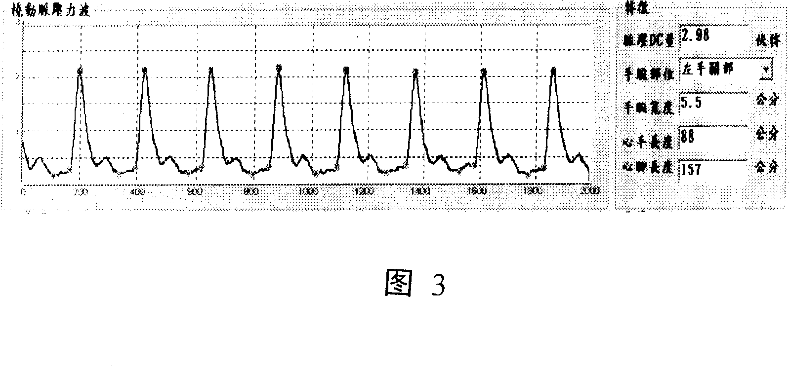 Instrumentation system and method for vein rib point