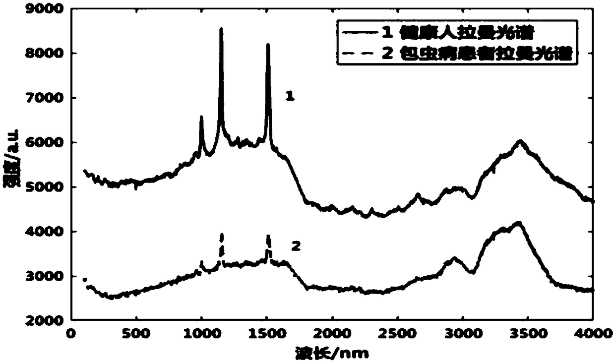 Echinococcosis serum Raman spectrum diagnostic apparatus based on optimal back-propagation neural network