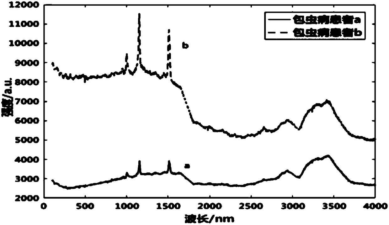 Echinococcosis serum Raman spectrum diagnostic apparatus based on optimal back-propagation neural network