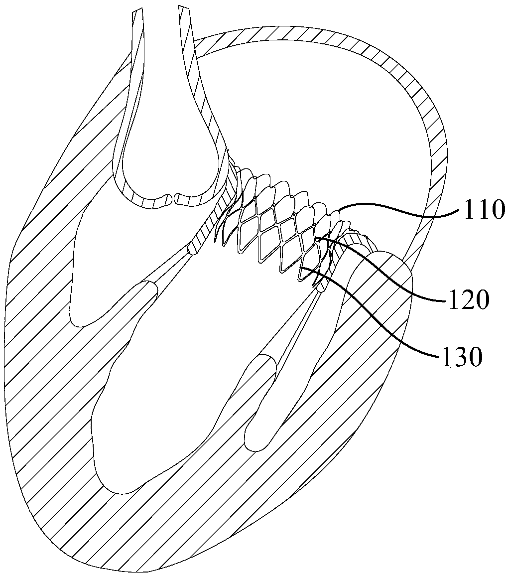 Mitral valve prosthesis, tricuspid valve prosthesis and stent thereof