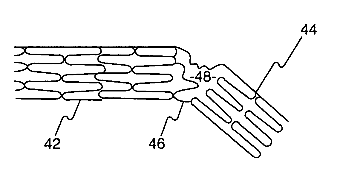 Hinged tissue implant and related methods and devices for delivering such an implant