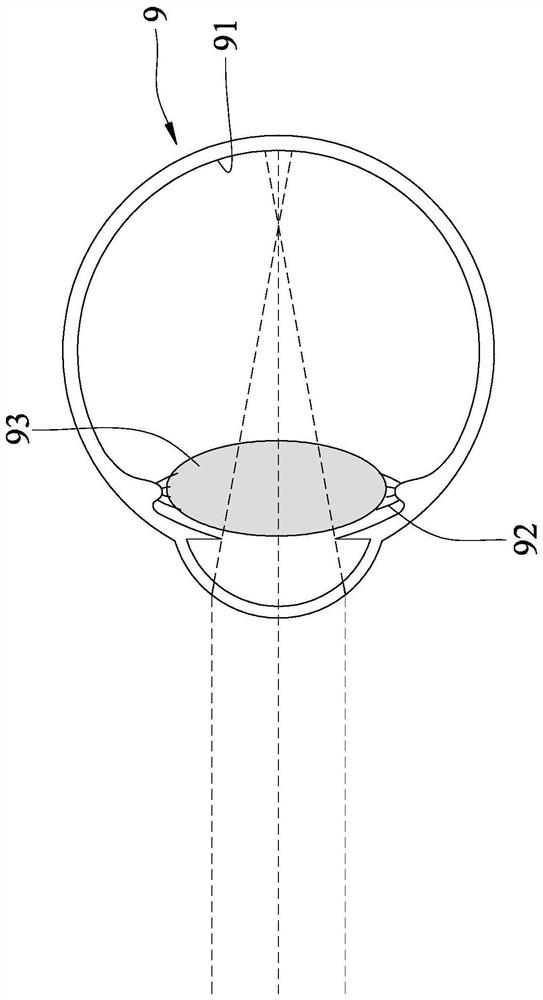 Continuous zoom contact lenses