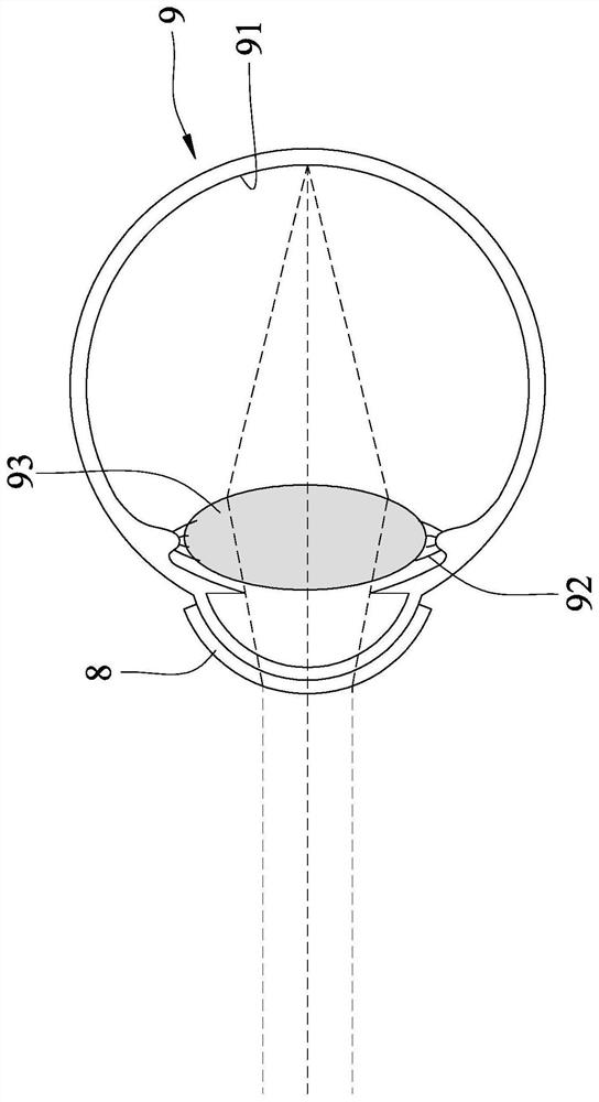 Continuous zoom contact lenses