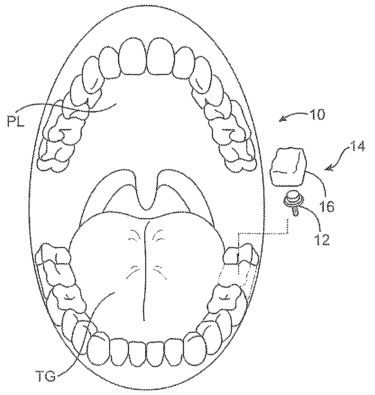 Methods and apparatus for transmitting vibrations