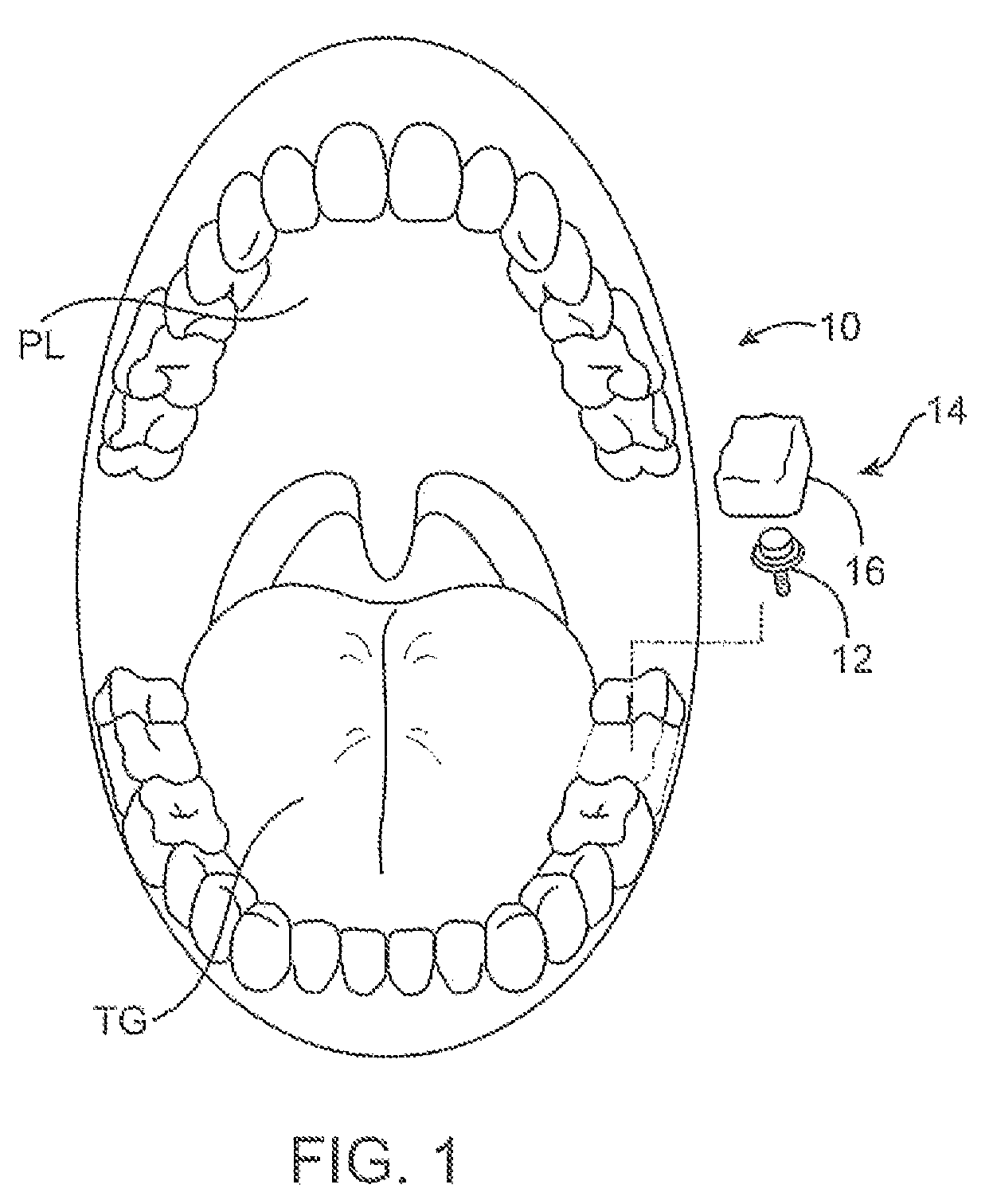 Methods and apparatus for transmitting vibrations