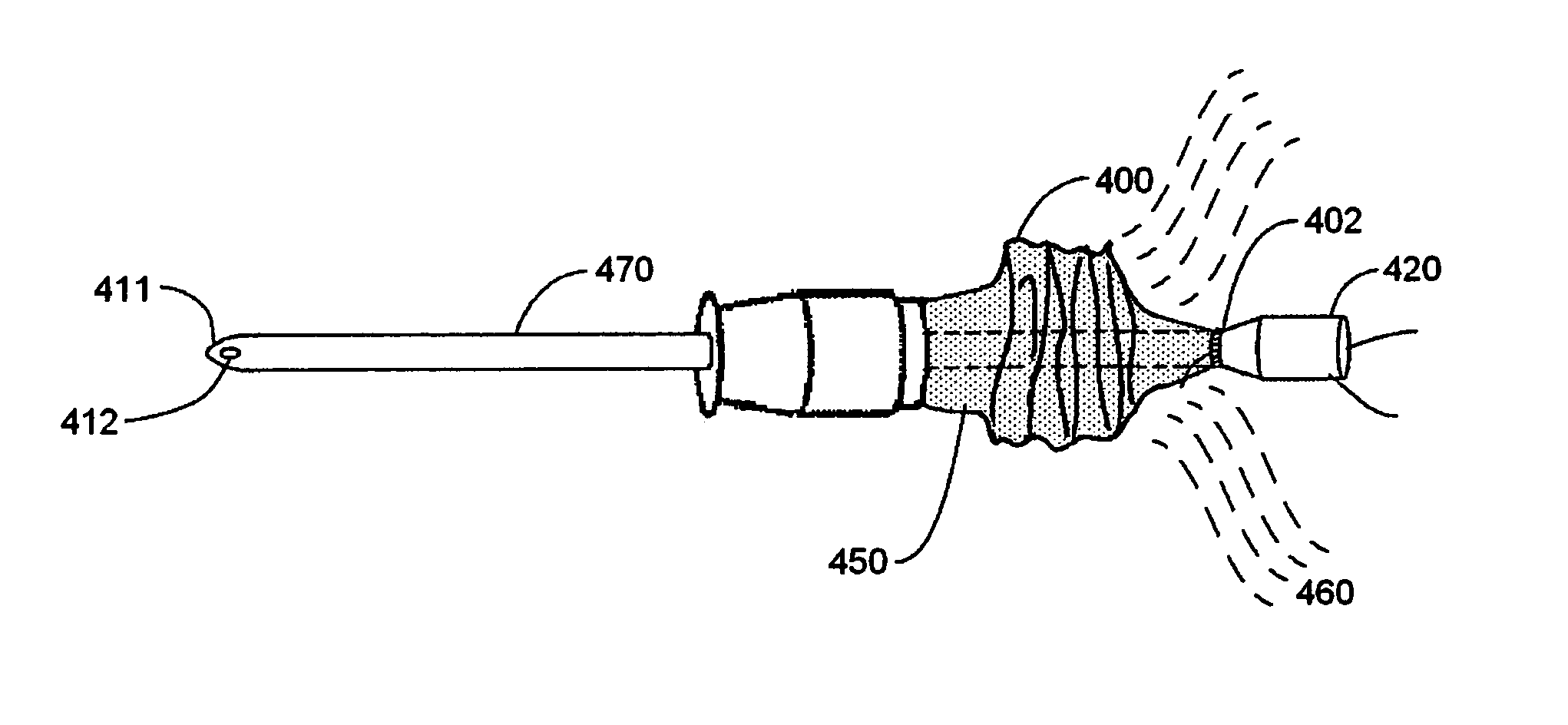 Catheter assembly having protective sheath