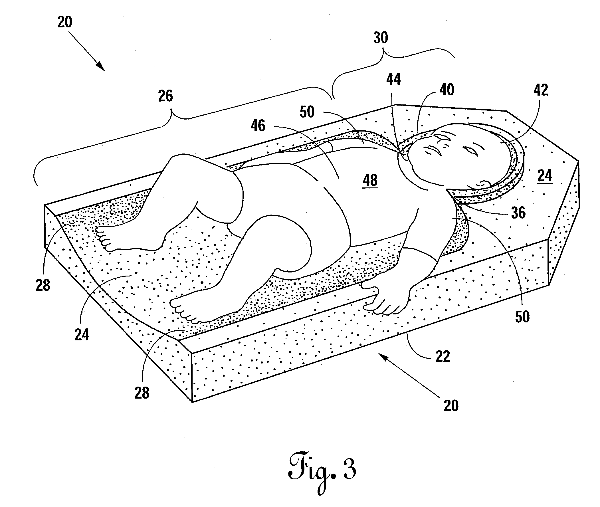 Mattress Incorporating a Headrest for Preventing and Correcting Non-Synostotic Cranial Deformities in Infants