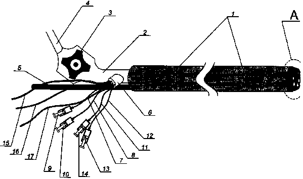 Method of surgical treatment of intestinal obstructions in narrow and large intestine and device for its implementation