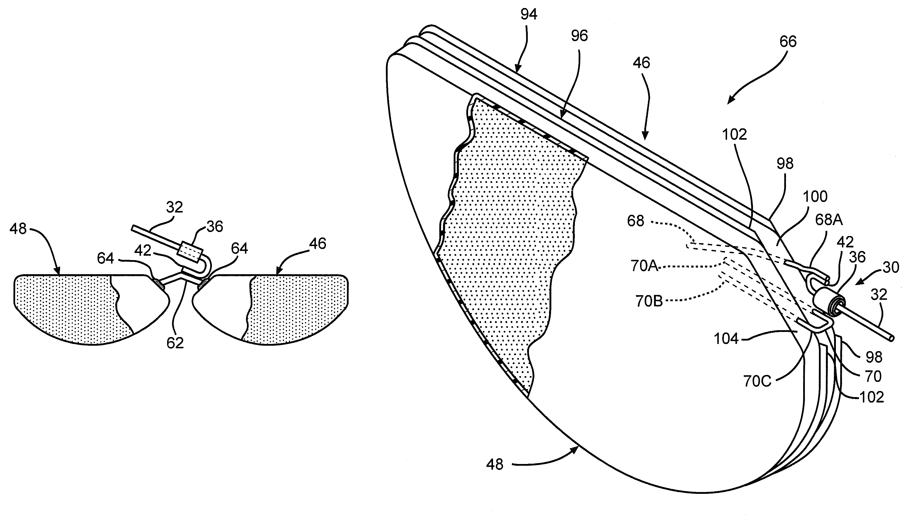 Dual anode capacitor with internally connected anodes