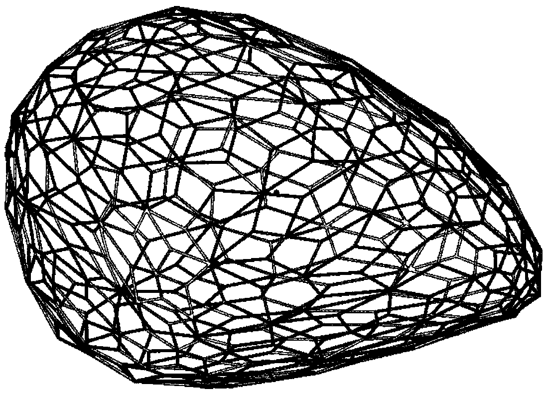 Gradient-degradable porous breast stent