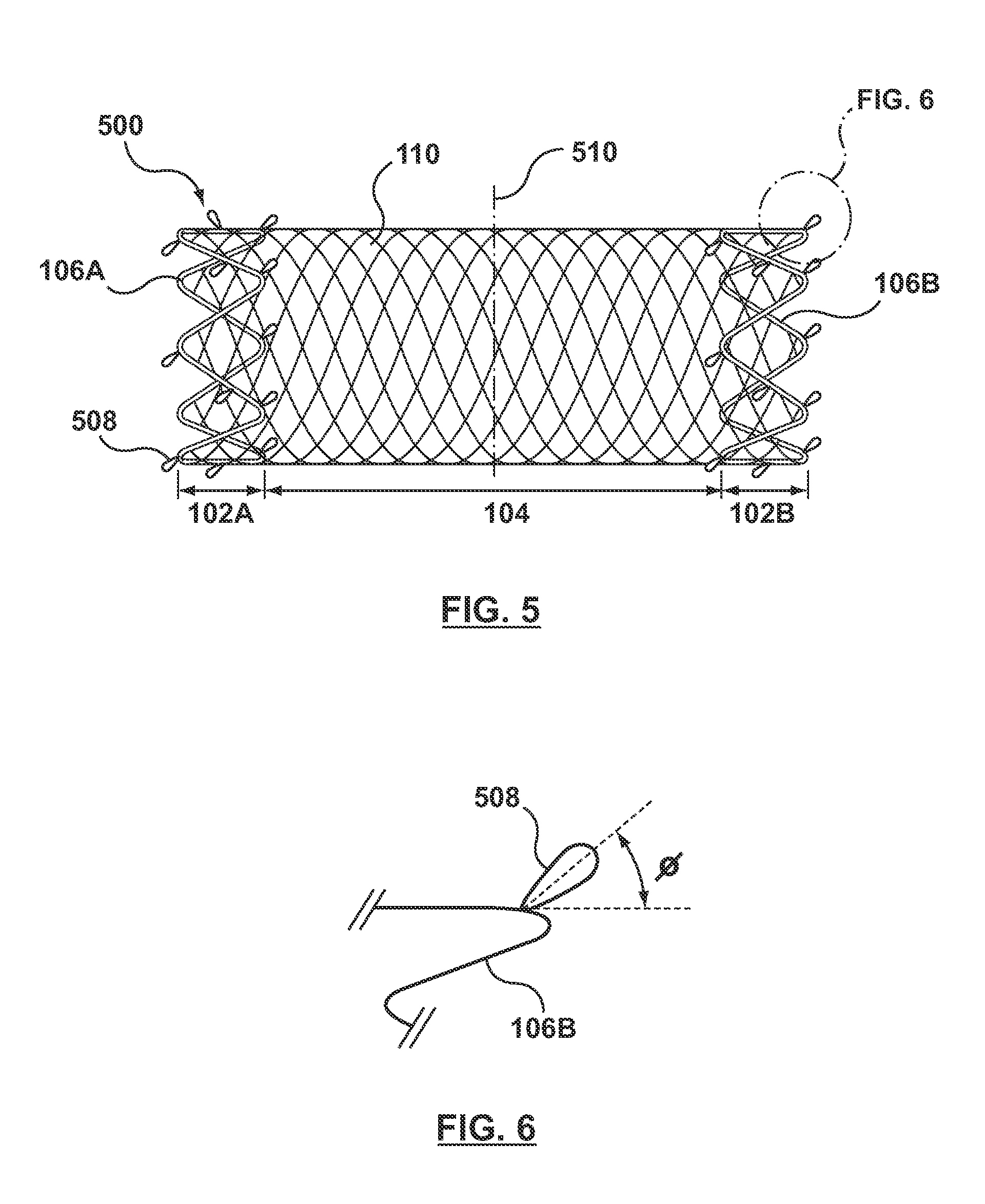 Biodegradable Stent Having Non-Biodegradable End Portions and Mechanisms for Increased Stent Hoop Strength