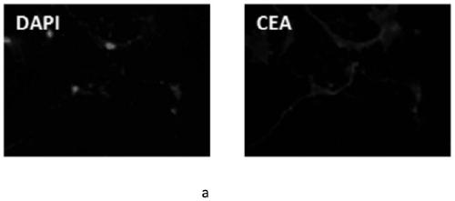 Culture medium and culture method for constructing liver tumor scaffoldless organoid