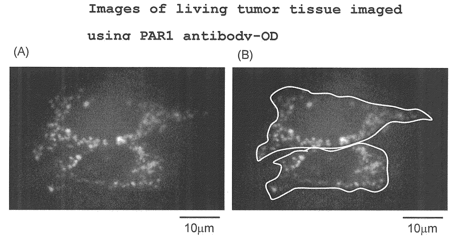 Cancer cell migration and cancer cell invasion inhibitor