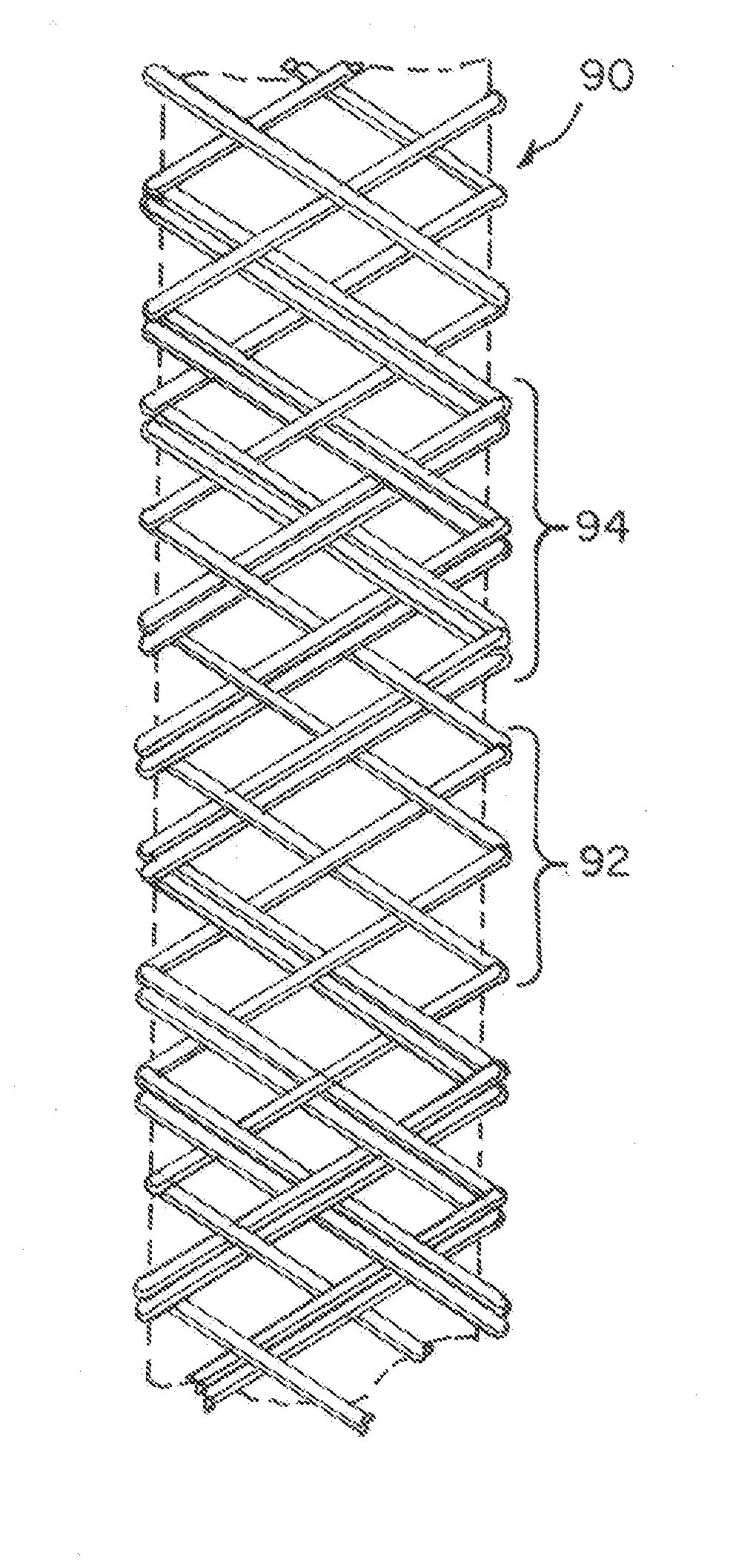 Multi-strand implant with enhanced radiopacity