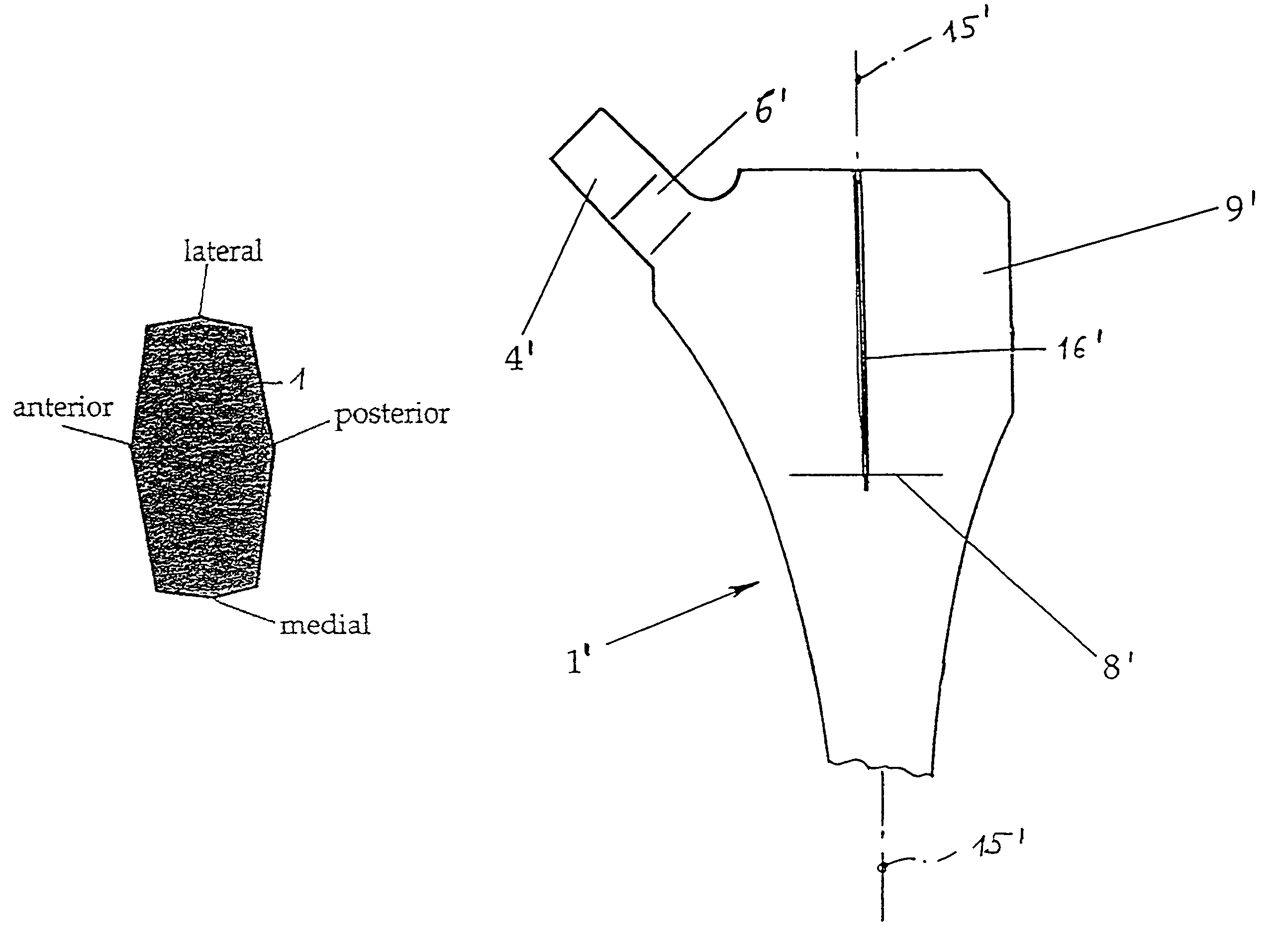 Flat shaft of a hip-joint prosthesis for anchoring in the femur