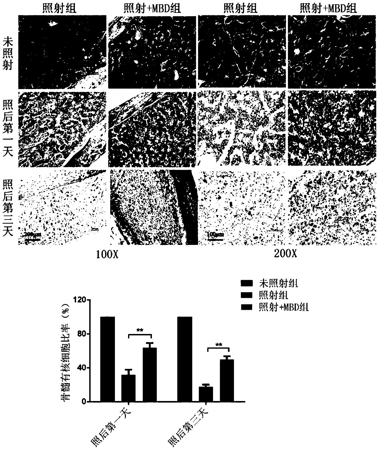 Application of Murabutide to preparation of medicine for preventing and treating bone marrow, small intestine and spleen injury caused by ionization radiation