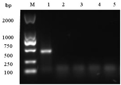 A Strain of Goose Astrovirus and Its Application