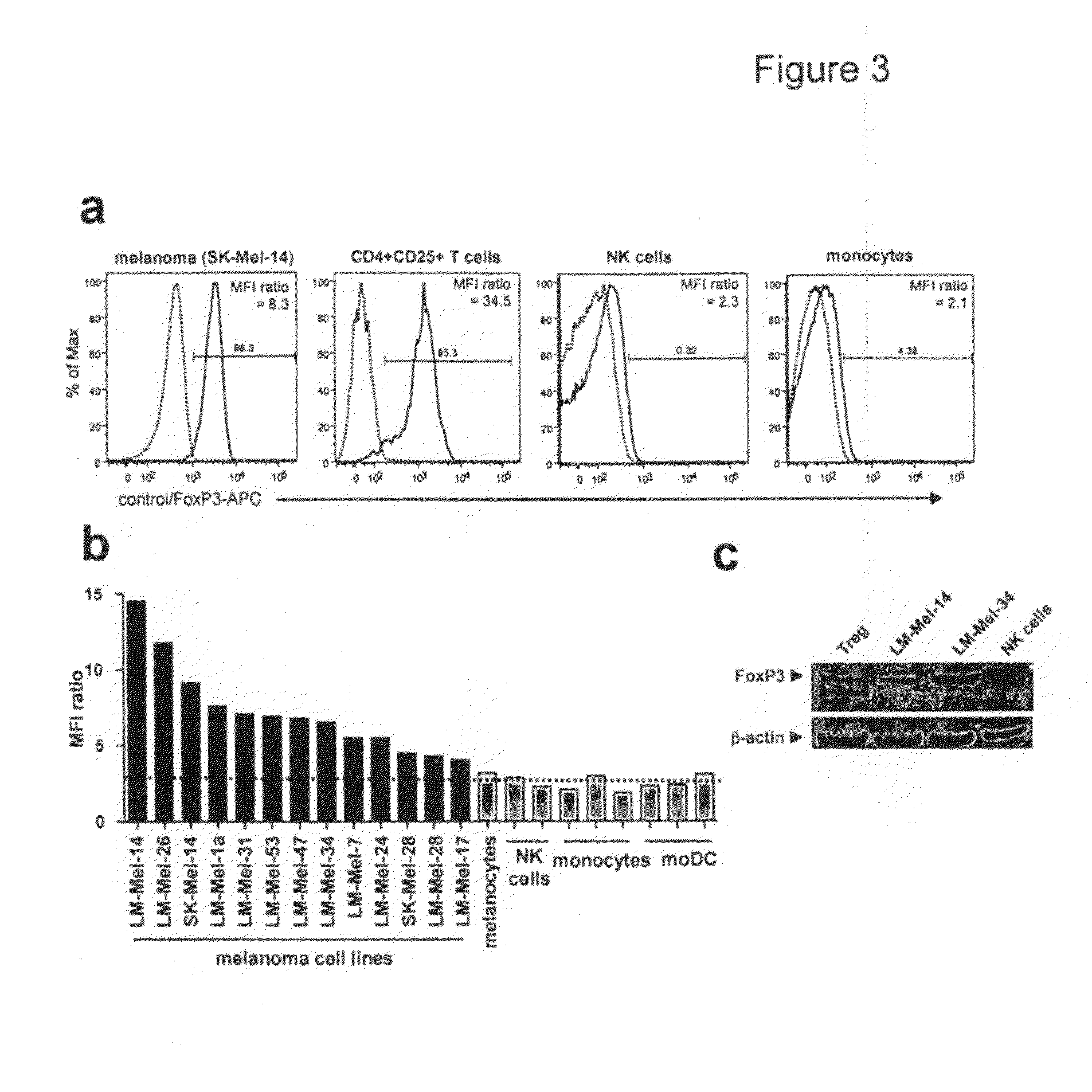 Expression of foxp3 by cancer cells