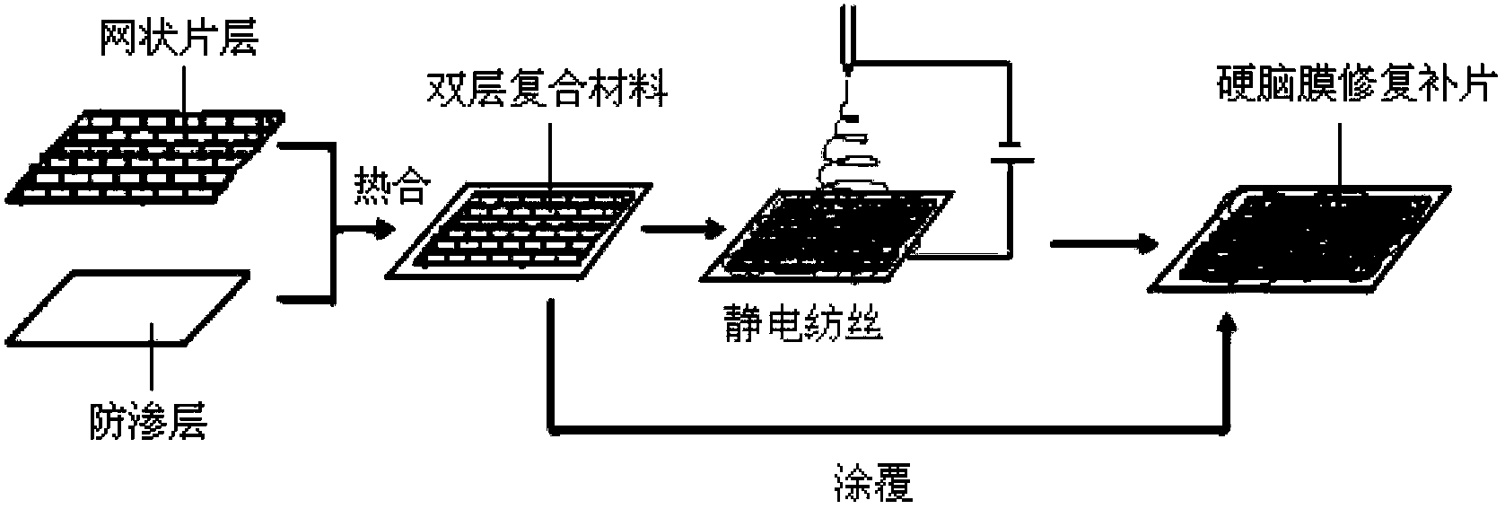 Absorbable endocranium healing patch and preparation method thereof