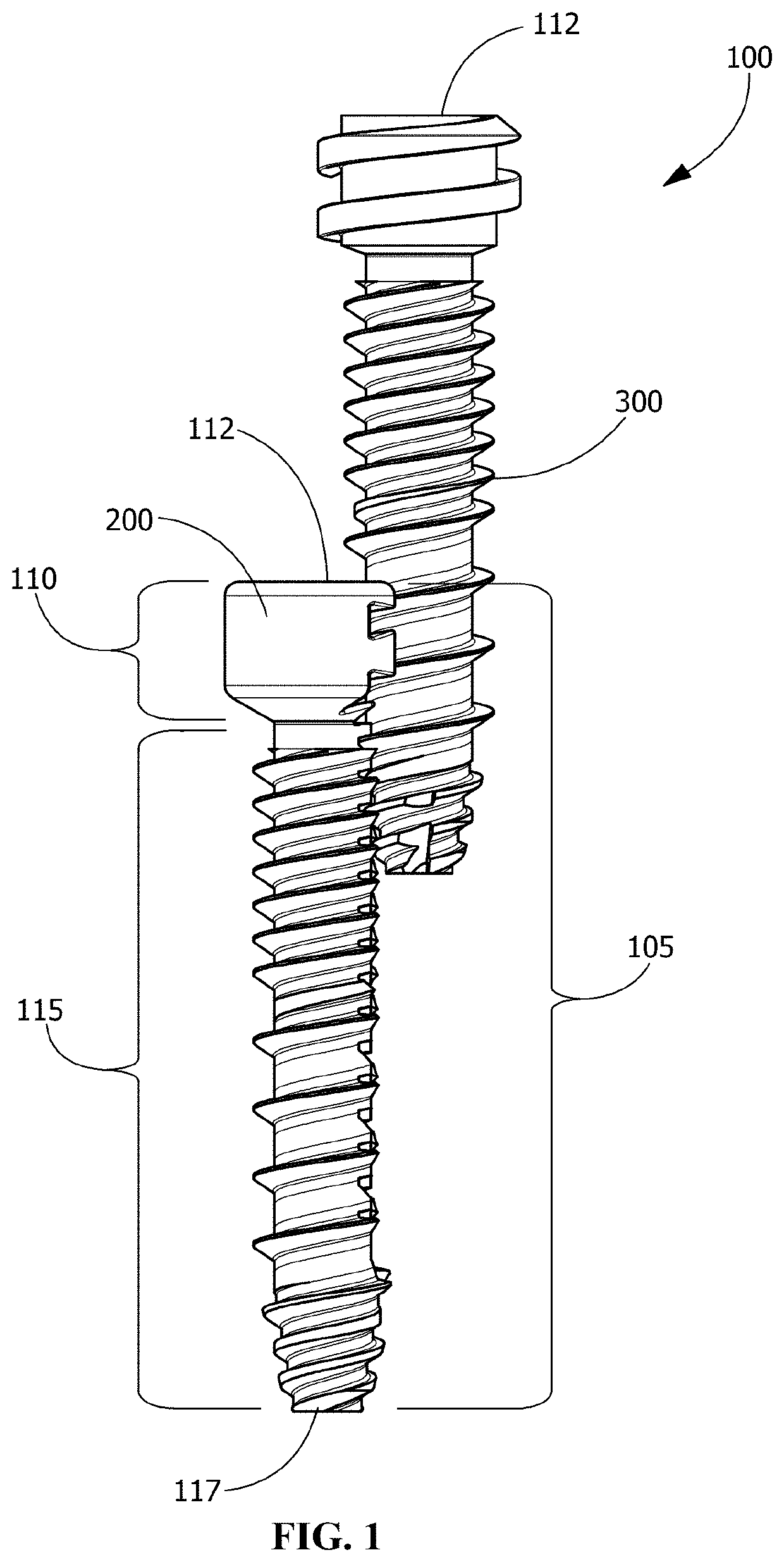 Implants and techniques for tissue fixation and fusion