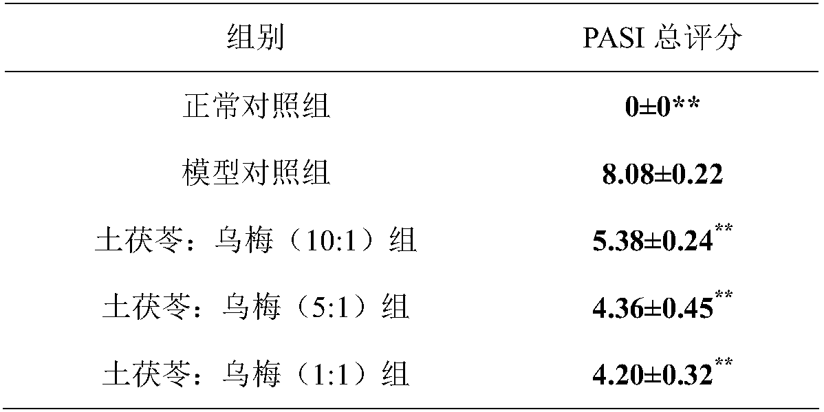 Rhizoma smilacis glabrae and fructus mume composition and application thereof in treatment of psoriasis