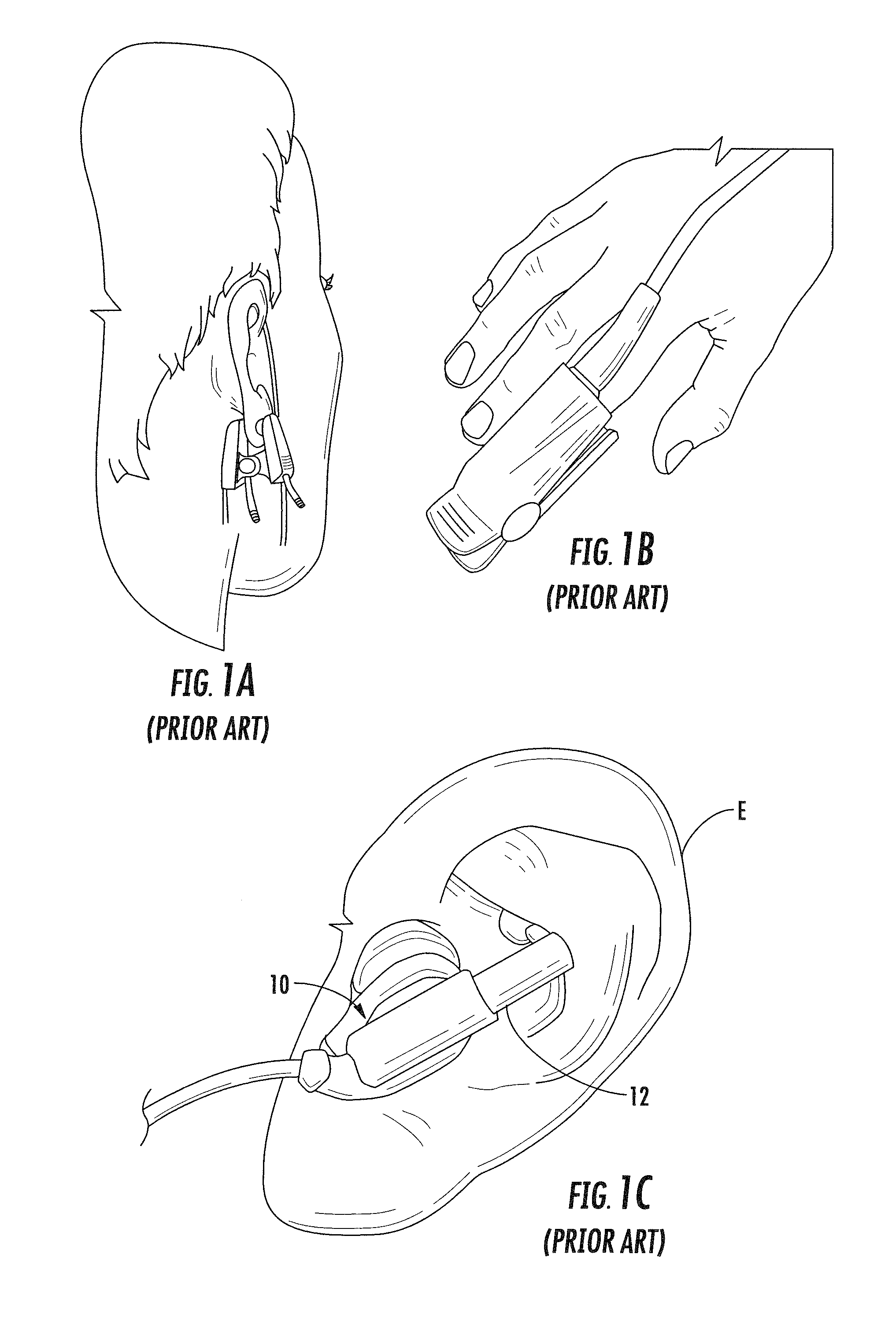 Physiological Monitoring Devices Having Sensing Elements Decoupled from Body Motion