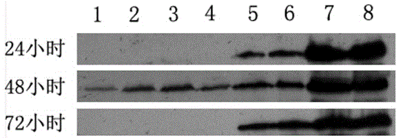 Method for guiding expression of major capsid proteins L1 of HPV16 (human papilloma virus 16) in pichia pastoris by using formaldehyde dehydrogenase promoter