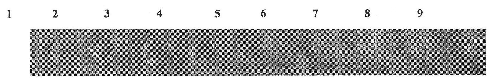 Method for quickly detecting pathogenic bacteria carried by plant seeds of bacterial black rot