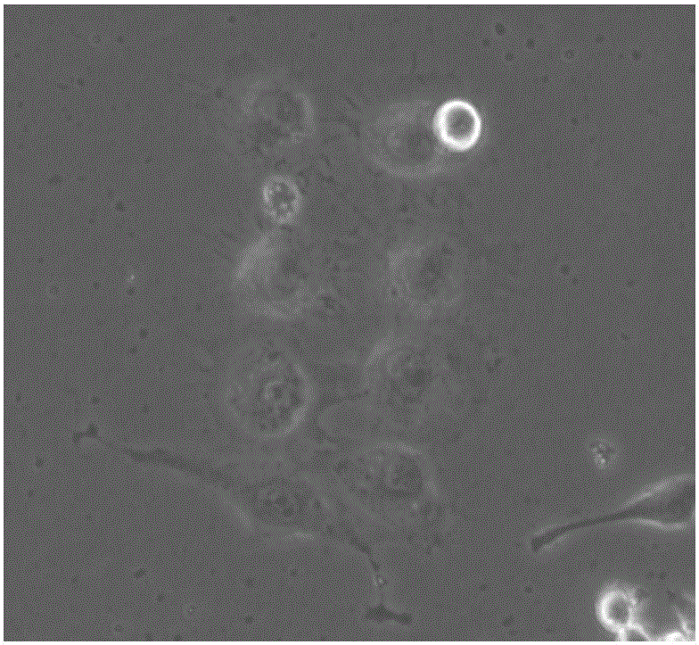 New target for regulating and controlling tumor cell metastasis and application thereof